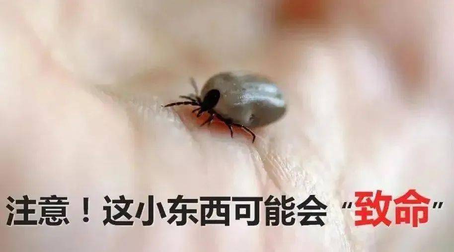电子体温计